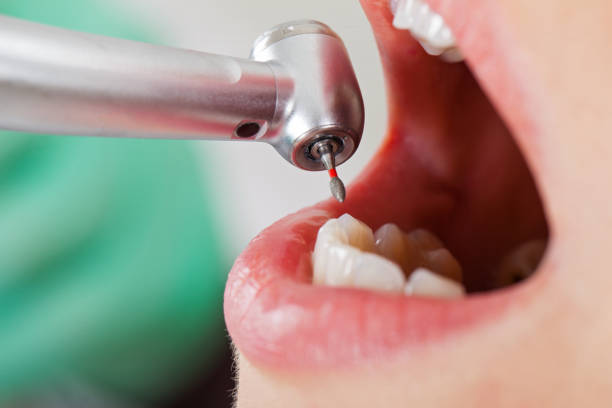 Best Pediatric Emergency Dentist in Cresskill, NJ
